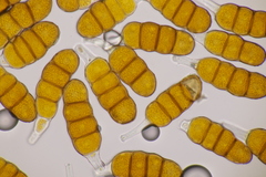 Phragmidium fragariae