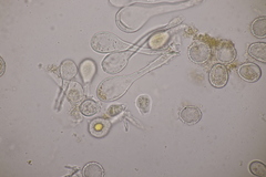 Phragmidium fragariae