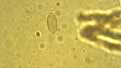 Peziza thozetii