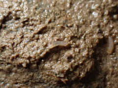 Caecum