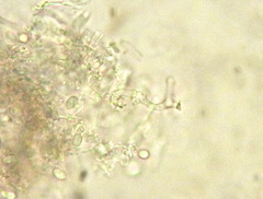 Crystallicutis serpens