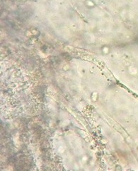 Crystallicutis serpens