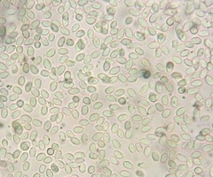 Crystallicutis serpens