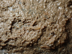 Caecum