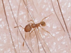 Pheidole bilimeki