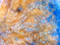 Lamprospora feurichiana