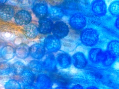 Lamprospora feurichiana