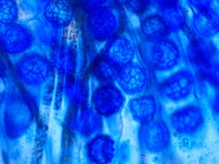 Lamprospora feurichiana