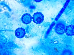 Lamprospora feurichiana