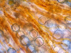 Lamprospora feurichiana