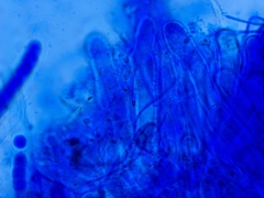Lamprospora feurichiana