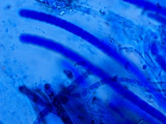 Lamprospora feurichiana
