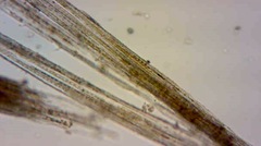 Nitzschia martiana