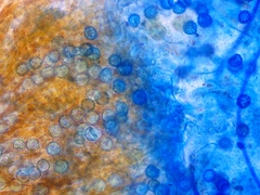 Lamprospora feurichiana