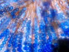 Lamprospora feurichiana