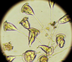 Vorticella
