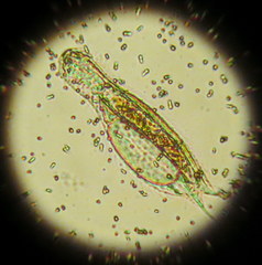 Gastrotricha