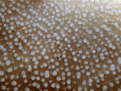 Ctenactis
