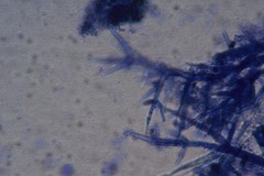 Mycogone calospora