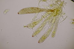 Pezicula cinnamomea