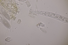 Pezicula cinnamomea