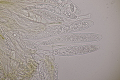 Pezicula cinnamomea