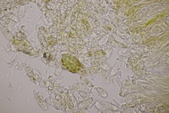 Pezicula cinnamomea