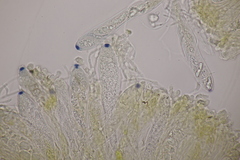 Pezicula cinnamomea