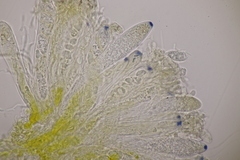 Pezicula cinnamomea