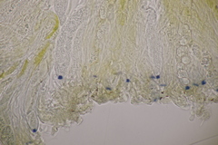 Pezicula cinnamomea