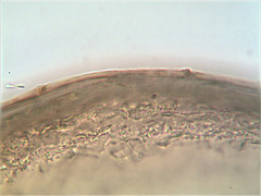 Chydorus