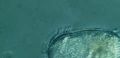 Spathidiopsis socialis