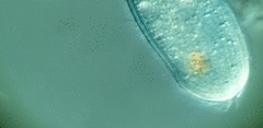 Spathidiopsis socialis
