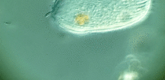 Spathidiopsis socialis
