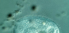 Spathidiopsis socialis