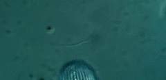 Spathidiopsis socialis