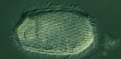 Spathidiopsis socialis