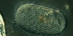 Spathidiopsis socialis