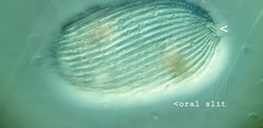 Spathidiopsis socialis