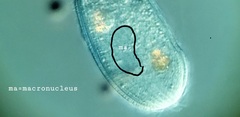 Spathidiopsis socialis