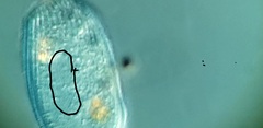 Spathidiopsis socialis