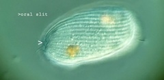 Spathidiopsis socialis