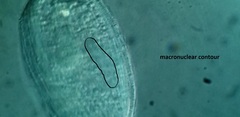 Spathidiopsis socialis