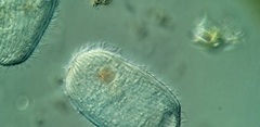 Spathidiopsis socialis