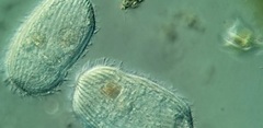 Spathidiopsis socialis