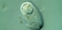 Spathidiopsis socialis