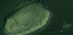 Spathidiopsis socialis