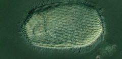 Spathidiopsis socialis