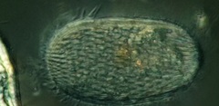Spathidiopsis socialis