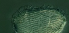 Spathidiopsis socialis